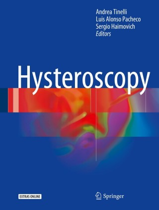 Cover image: Hysteroscopy 9783319575582