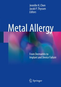 Cover image: Metal Allergy 9783319585024