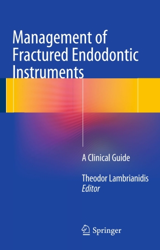 Cover image: Management of Fractured Endodontic Instruments 9783319606507