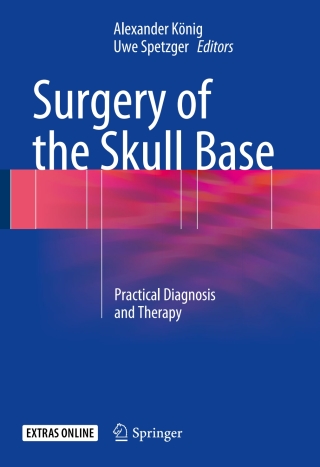 Omslagafbeelding: Surgery of the Skull Base 9783319640174