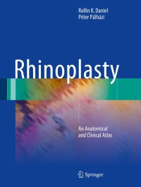 Cover image: Rhinoplasty 9783319673134