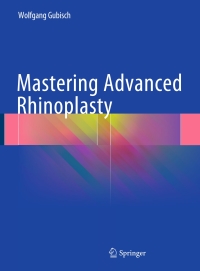 表紙画像: Mastering Advanced Rhinoplasty 9783319675367