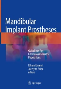 表紙画像: Mandibular Implant Prostheses 9783319711799
