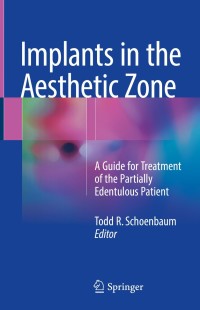 Cover image: Implants in the Aesthetic Zone 9783319726007