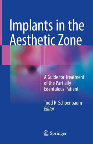 Cover image: Implants in the Aesthetic Zone 9783319726007