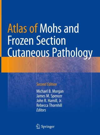 Cover image: Atlas of Mohs and Frozen Section Cutaneous Pathology 2nd edition 9783319748467