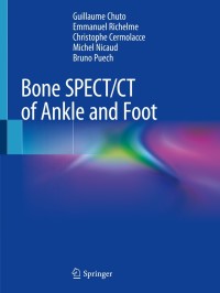 Cover image: Bone SPECT/CT of Ankle and Foot 9783319908106