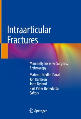 表紙画像: Intraarticular Fractures 9783319976006