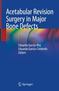 Cover image: Acetabular Revision Surgery in Major Bone Defects 9783319985954