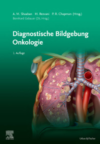 صورة الغلاف: Diagnostische Bildgebung Onkologie 9783437240317