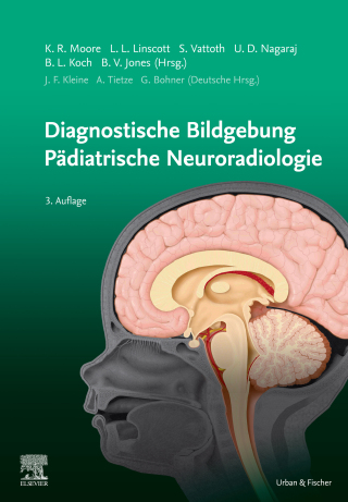 Cover image: Diagnostic Imaging: Pädiatrische Neuroradiologie 3rd edition 9783437237157