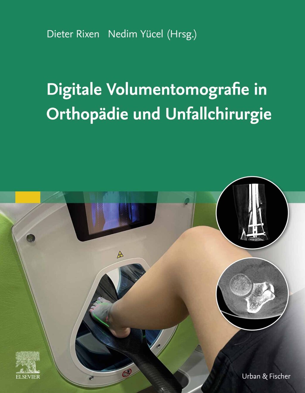 Digitale Volumentomografie in Orthopädie und Unfallchirurgie 1st Edition