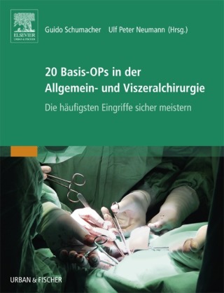 Cover image: 20 Basis-OPs in der Allgemein- und Viszeralchirurgie 1st edition 9783437248153