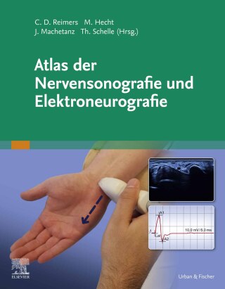 Imagen de portada: Atlas der Nervensonografie und Elektroneurografie 9783437218910