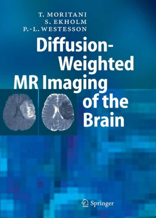 Titelbild: Diffusion-Weighted MR Imaging of the Brain 9783540034391