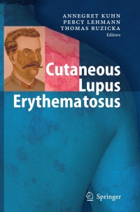 Cover image: Cutaneous Lupus Erythematosus 1st edition 9783540442660