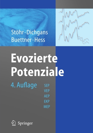 Imagen de portada: Evozierte Potenziale 4th edition 9783540017738
