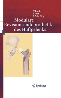 表紙画像: Modulare Revisionsendoprothetik des Hüftgelenks 1st edition 9783540200604