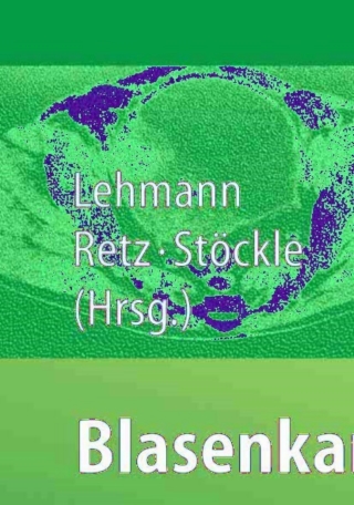 Cover image: Blasenkarzinom 1st edition 9783540205043