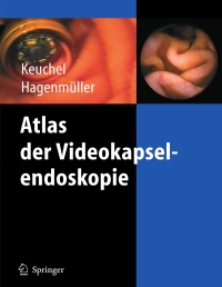 Cover image: Atlas der Videokapselendoskopie 1st edition 9783540202394