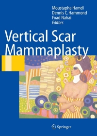 表紙画像: Vertical Scar Mammaplasty 1st edition 9783540221012