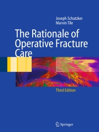 Cover image: The Rationale of Operative Fracture Care 3rd edition 9783540228509