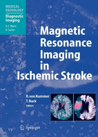 Imagen de portada: Magnetic Resonance Imaging in Ischemic Stroke 1st edition 9783540008613
