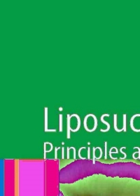 Cover image: Liposuction 1st edition 9783540280422