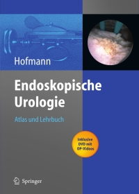 صورة الغلاف: Endoskopische Urologie 1st edition 9783540206798