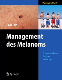 Cover image: Management des Melanoms 1st edition 9783540289876