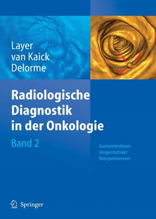 Cover image: Radiologische Diagnostik in der Onkologie 1st edition 9783540293187
