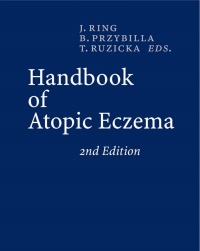 表紙画像: Handbook of Atopic Eczema 2nd edition 9783540231332
