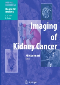 Cover image: Imaging of Kidney Cancer 1st edition 9783540211297