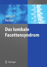 Imagen de portada: Das lumbale Facettensyndrom 2nd edition 9783540277095