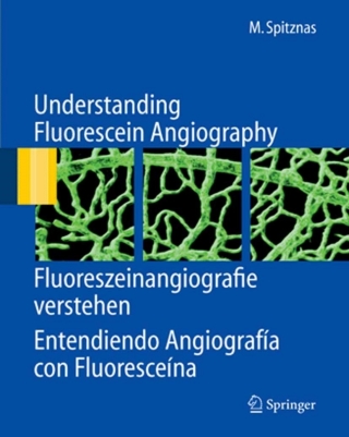 表紙画像: Understanding Fluorescein Angiography, Fluoreszeinangiografie verstehen, Entendiendo Angiografía con Fluoresceína 9783540300601