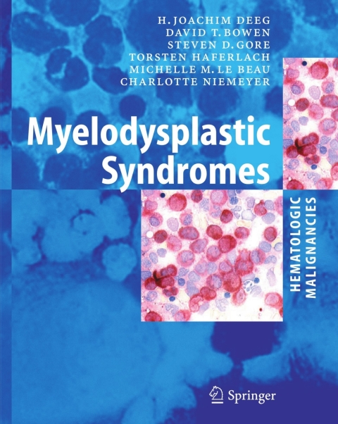 Myelodysplastic Syndromes - FULL INSTANT DOWNLOAD | PDF DOCX EPUB