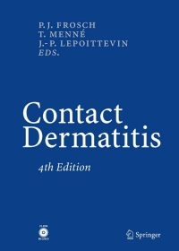 Cover image: Contact Dermatitis 4th edition 9783540244714