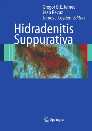 Imagen de portada: Hidradenitis Suppurativa 1st edition 9783540331001