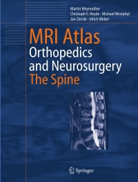 صورة الغلاف: MRI Atlas 9783540335337