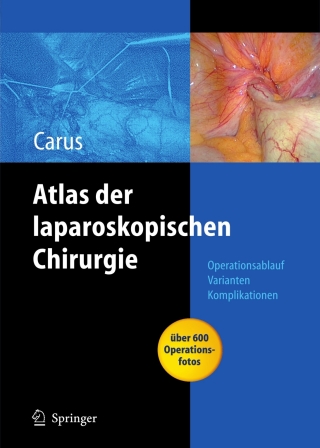 Cover image: Operationsatlas Laparoskopische Chirurgie 9783540336730
