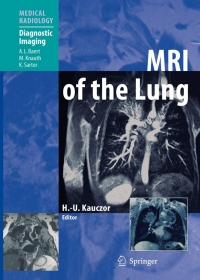 Titelbild: MRI of the Lung 1st edition 9783540346180