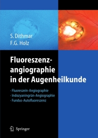 Imagen de portada: Fluoreszenzangiographie in der Augenheilkunde 9783540352235
