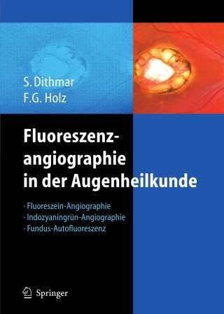 Cover image: Fluoreszenzangiographie in der Augenheilkunde 9783540352235