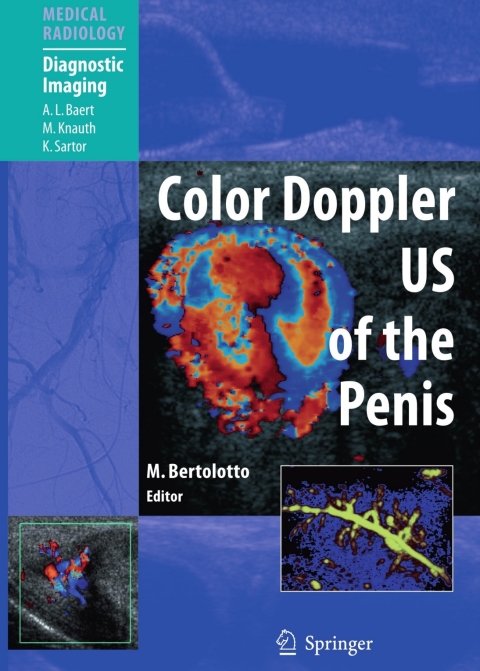 Color Doppler US of the Penis, 1st Edition - FULL INSTANT DOWNLOAD | PDF DOCX EPUB