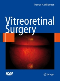 Imagen de portada: Vitreoretinal Surgery 9783540375814