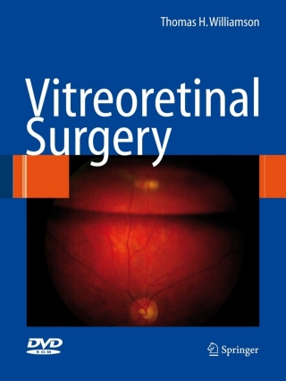 Immagine di copertina: Vitreoretinal Surgery 9783540375814