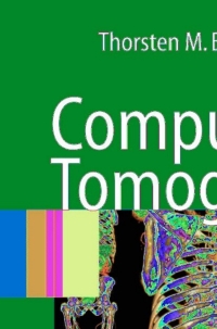 Cover image: Computed Tomography 9783540394075