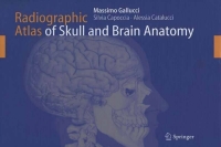 صورة الغلاف: Radiographic Atlas of Skull and Brain Anatomy 9783642070594