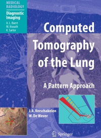 表紙画像: Computed Tomography of the Lung 9783540261872