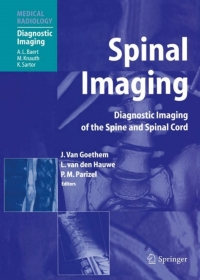 Cover image: Spinal Imaging 1st edition 9783540213444